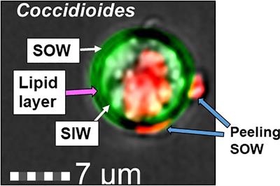 Lipid Secretion by Parasitic Cells of Coccidioides Contributes to Disseminated Disease